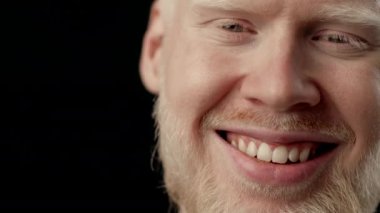 Albinizmli genç bir adam sıcak bir gülümseme sergiliyor, beyaz saçlarını ve açık tenini gösteriyor. Karanlık arka plan onun özelliklerini geliştiriyor, çarpıcı bir görsel etki yaratıyor..