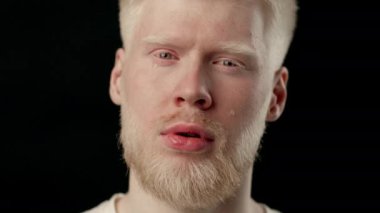 Albino özellikleri ve beyaz saçlı genç bir adam değişik duygular sergiliyor. Soluk teni koyu arkaplanla çelişiyor ve çarpıcı bir görsel etki yaratıyor. Samimiyetini yakaladığı an.