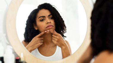 Problem Cildi Konsepti. Aynaya Bakan ve Sivilceye Dokunan, Sivilceler İçin Endişeli, Omuzdan Bakış, Seçici Odaklanma