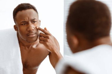Problem Cildi. Üzgün Afrikalı Amerikalı bir adam, evdeki modern banyoda aynadaki yansımasına bakarak sivilce sivilcesine dokunuyor. Dermatoloji, Erkek Yüz Cildi Konsepti. Seçici Odaklanma