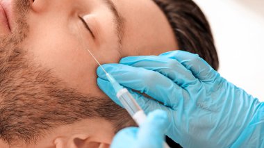 Sakallı adam, tanınmayan güzellik uzmanının göz kırışıklıklarına güzellik iğnesi yaptırıyor. Estetik kliniğinde orta yaşlı yakışıklı bir adam için göz kaldırma prosedürleri uyguluyor.