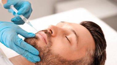 Çekici sakallı adam estetik kliniğe gidip dudak dolgusu yaptırıyor, yakın plan çekiyor. Orta yaşlı iş adamı erkek spa salonunda güzellik iğnesi yaptırıyor. Yüz bakımı, erkek konsepti için yaşlanma karşıtı tedavi
