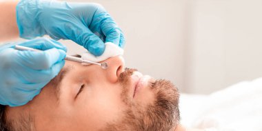 Tıbbi eldivenli tanınmayan kozmetik uzmanı orta yaşlı erkek burnundan siyah noktalar çıkarıyor, aletler, pamuk pedler ve yan görüş kullanıyor. Yakışıklı bir adamın kozmetik uzmanına yakın çekimi.