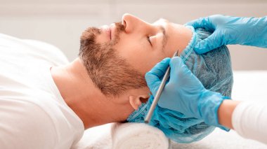 Estetik ameliyat veya düzeltmeden önce alnında kalem izi olan yakışıklı bir adam ameliyata hazır. Estetik kliniğinde ameliyattan önce insan yüzüne estetik ameliyat izleri uygulayan plastik cerrah.