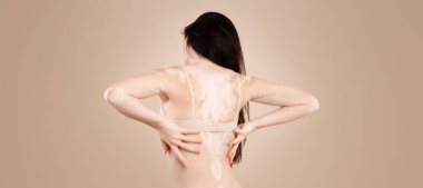 Vitiligo Derisi. Bej rengi iç çamaşırlarıyla stüdyoda poz veren, otoimmün hastalığı olan, ellerini arkada tutan, boşluğu kopyalayan bir kadın.