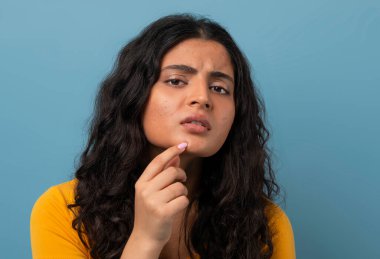 Stresli, esmer, genç Hintli kadın mavi stüdyo arka planında yüzüne dokunuyor, cilt sorunları yaşıyor, yakın çekim. Sivilceler, sivilceler, kırışıklıklar, donuk cilt