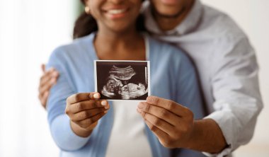 Siyah ve beyaz bebek ultrasonunda birbirine sarılan siyah çift elleri, beyaz arka plan. Ultrason görüntüsüne seçici odaklanma, duygusal Afrikalı Amerikan ailesi mutluluklarını paylaşıyor, panorama