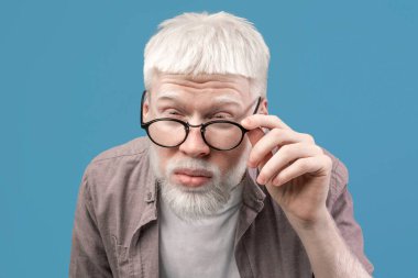 Gözlerim iyi görmüyor. Gözlüklü albino adam gözlerini kısıyor, kötü görüyor, mavi arka planda bir şey görmeye çalışıyor. Sıra dışı görünüşlü, soluk tenli, beyaz saçlı, görme sorunu olan bir adam.