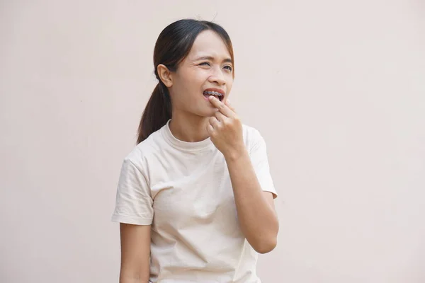 Mulher Asiática Tem Lábios Doloridos — Fotografia de Stock