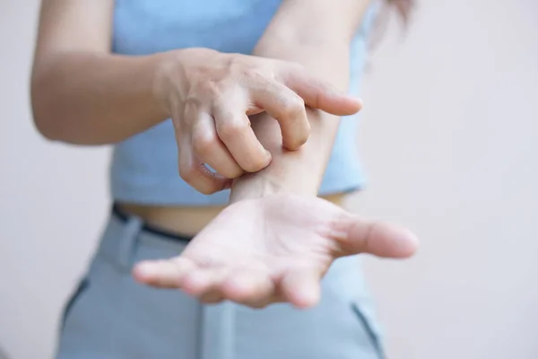 Asian woman having itchy skin on hand