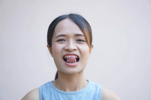Bir Kadın Sıcaktan Görmek Için Dilini Dışarı Çıkarır — Stok fotoğraf