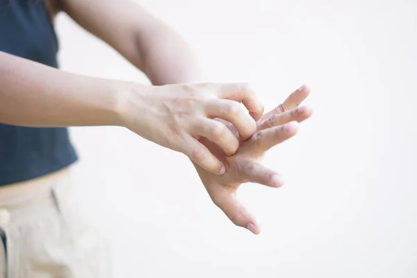 Asian woman having itchy skin on hand