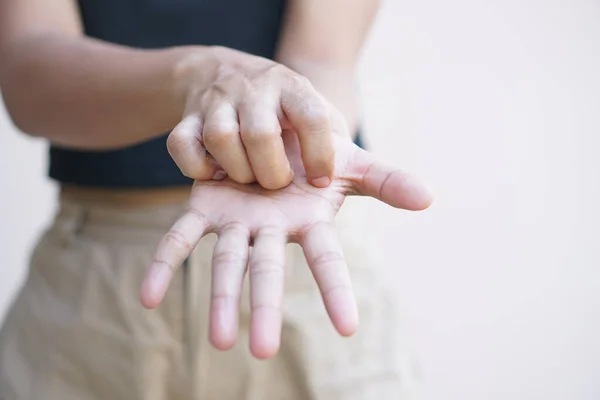 Asiatisk Kvinna Med Kliande Hud Handen — Stockfoto