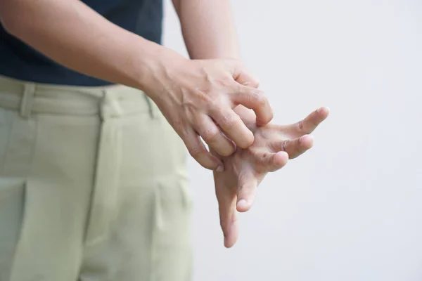 Woman having itchy skin on hands and arms