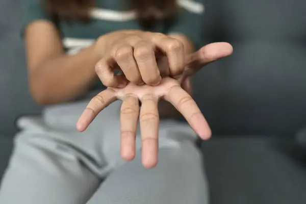 Asian woman has itchy skin on her hands