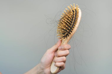 Hair fall problem concept. Shocked Asian woman looking at many hair lost in her hand and comb.