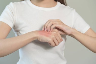 person have red rash on arm from insect bite allergic. clipart