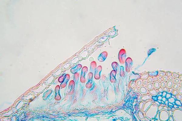 Zdjęcie Mikroskopu Rdzy Parowej Puccinia Graminis Liściu — Zdjęcie stockowe