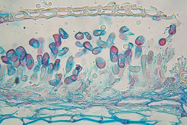 Mikroskopaufnahme Von Dampfrost Puccinia Graminis Auf Blatt — Stockfoto