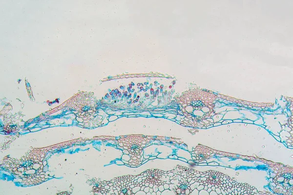 Mikroskop Foto Ångrost Puccinia Graminis Blad — Stockfoto