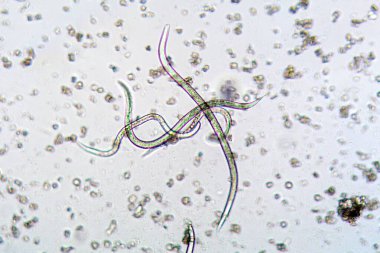 Nematode Steinernema feltiae mikroskop altında, tarımda ve bahçıvanlıkta mantar sineklerini enfekte etmek için biopestisit olarak kullanılan tür. 