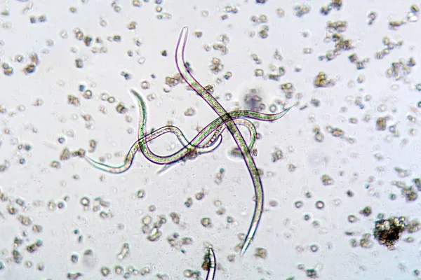 显微镜下的线虫Steinernema Feltiae 是一种用于在农业和园艺中感染真菌的生物农药 — 图库照片