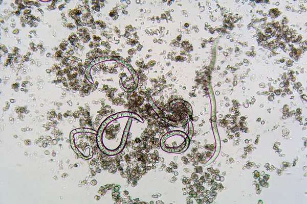 Nicień Steinernema Feltiae Pod Mikroskopem Gatunki Stosowane Jako Biopestycydy Zakażenia — Zdjęcie stockowe