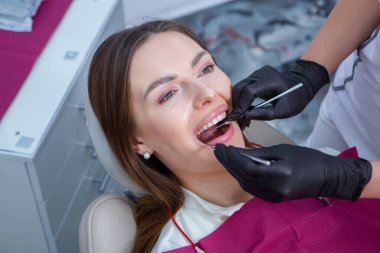 Sağlıklı, beyaz dişleri olan güzel bir kadın dişçi koltuğunda diş ameliyatı sırasında ağzı açık oturuyor. Diş sağlığı kliniği. Stomatoloji