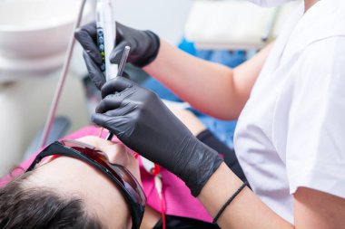 Stomatoloji ve diş bakımı. Diş hekimliği ve oral sağlık. Kadının dişçi kliniğinde diş muayenesi var. Yaklaş genç beyaz kız yüzü..