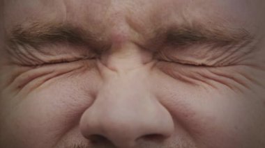 Gözlerini kısarak bakan, detaylı yüz ifadeleri ve kırışıklıklar gösteren bir kişinin yakın çekimi.