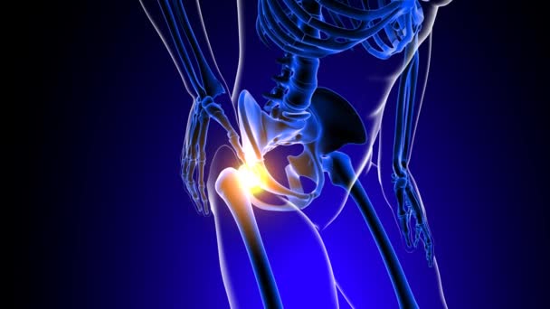 Hip Joint Pain Anatomy Medical Concept Animation — Stock Video