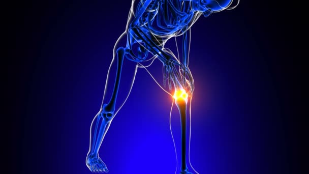 Kniegewrichtspijn Anatomie Voor Medisch Concept Animatie — Stockvideo