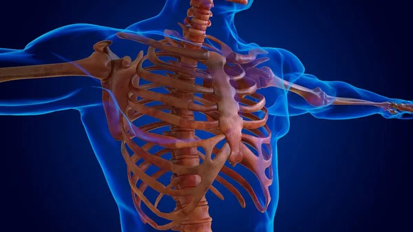 医学的概念のための人間の損傷骨格3Dイラスト — ストック写真