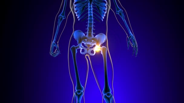 Hip Joint Pain Anatomy Medical Concept Animation — Stock Video