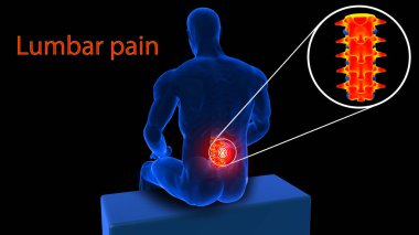 Tıbbi konsept 3 boyutlu illüstrasyon için insan iskeleti sırt ağrısı anatomisi