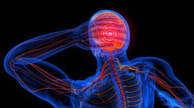 Tıbbi konsept için baş ağrısı anatomisi 3 boyutlu illüstrasyon