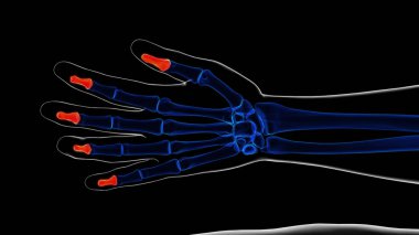 Human skeleton hand distal phalanges bone anatomy for medical concept 3D illustration clipart