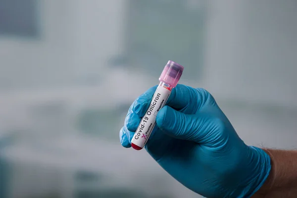 stock image hand in medical blue glove is handling a blood test tube with corona markers in front of a lab room