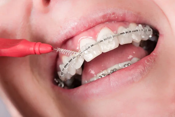 用牙刷对妇女或青少年的嘴进行近距离检查就是用牙刷清洁她的牙齿 — 图库照片