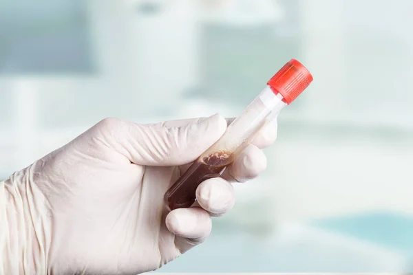 Close Mão Luvas Médicas Manipulação Tubo Teste Sangue Para Análise — Fotografia de Stock