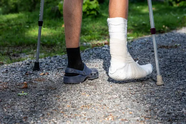 Broken ankle and a leg cast. Leg splint.