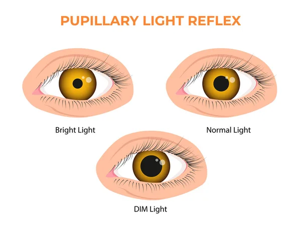 Pupilární Reflexní Světlo Plr Nebo Fotopilární Reflex — Stockový vektor