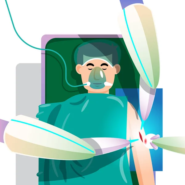 Brazo Robótico Realiza Una Cirugía Paciente Cirugía Robótica Incisión Pequeña — Vector de stock