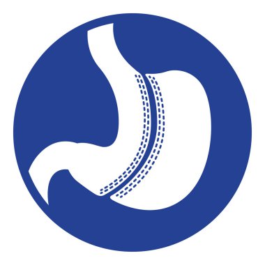 Bariatrik cerrahi prosedürlü mide ikonu, anatomi. Tıbbi ve eğitici materyaller için ideal