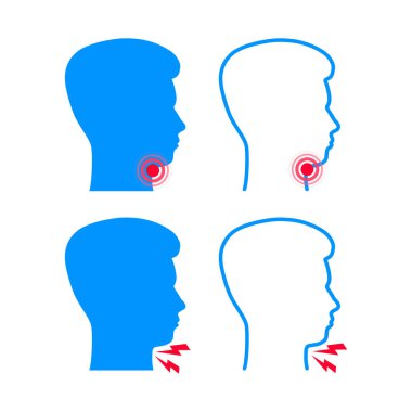 Boğaz ağrısı. Belirtiler Simgesi. Bakteriyel ve viral enfeksiyon, larenjit. Vektör stok illüstrasyonu