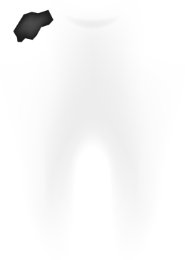 Caries 'in gelişim aşaması. Diş bakımı konsepti. Sağlıklı Dişler. hisse illüstrasyonu.