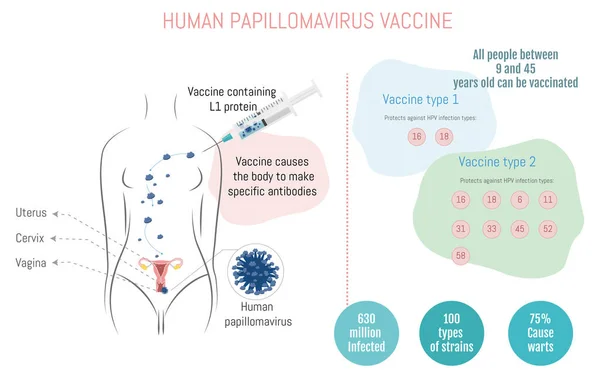Infografía Sobre Cómo Funcionan Las Vacunas Contra Virus Del Papiloma — Vector de stock