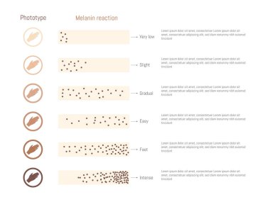 Fotokopi ve melanin reaksiyonu diyagramı. Vektör EPS 