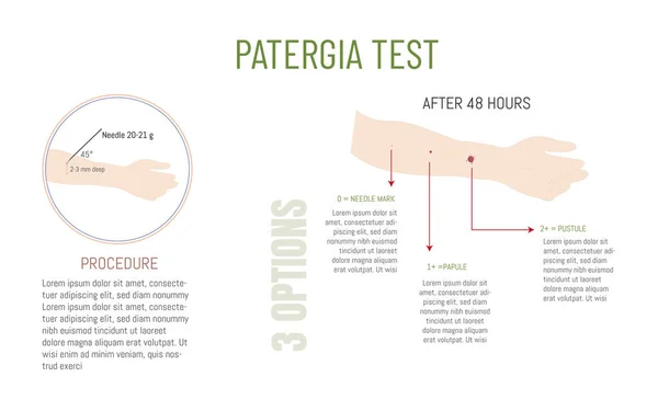 Infographic Εξηγεί Τεστ Patergia Για Την Ανίχνευση Της Νόσου Του — Διανυσματικό Αρχείο