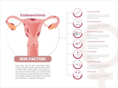 Infographic on risk factors in endometriosis.